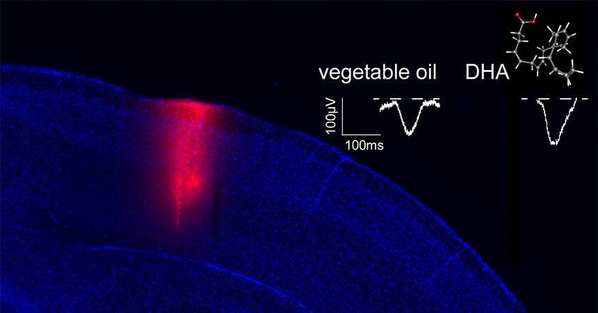 Micronutrients promote cortical connectivity